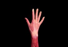 “갑자기 멍이 잘 들어요”… 혈관 나이, 생각보다 더 빨리 늙고 있을 수 있습니다 persons left hand with pink paint